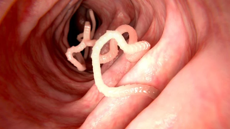 parasiten im körper symptome frau